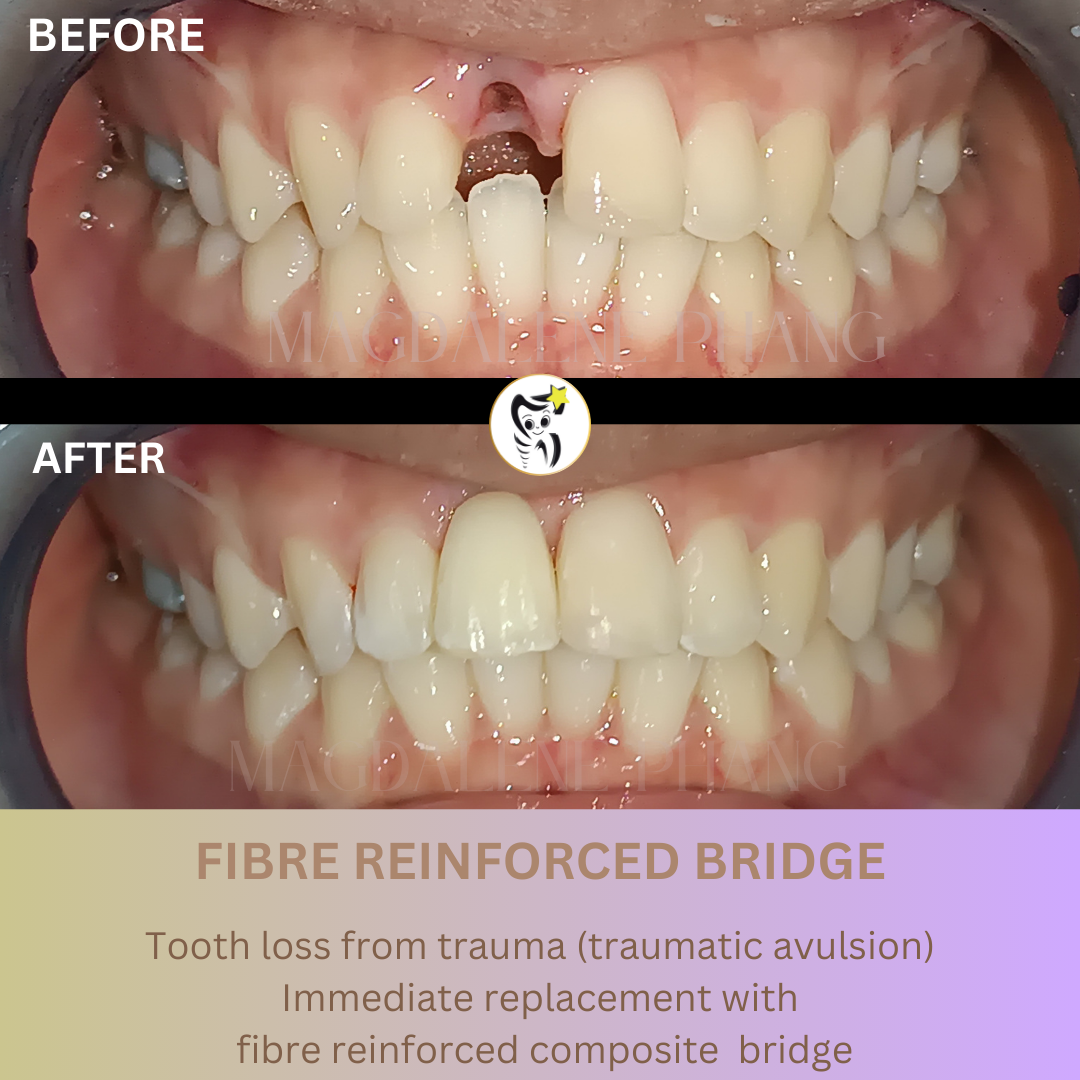 Before and After Dental Treatment
