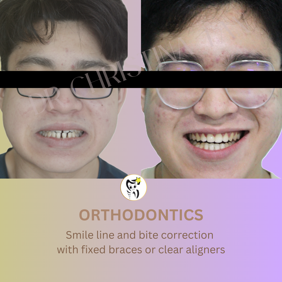 Before and After Dental Treatment
