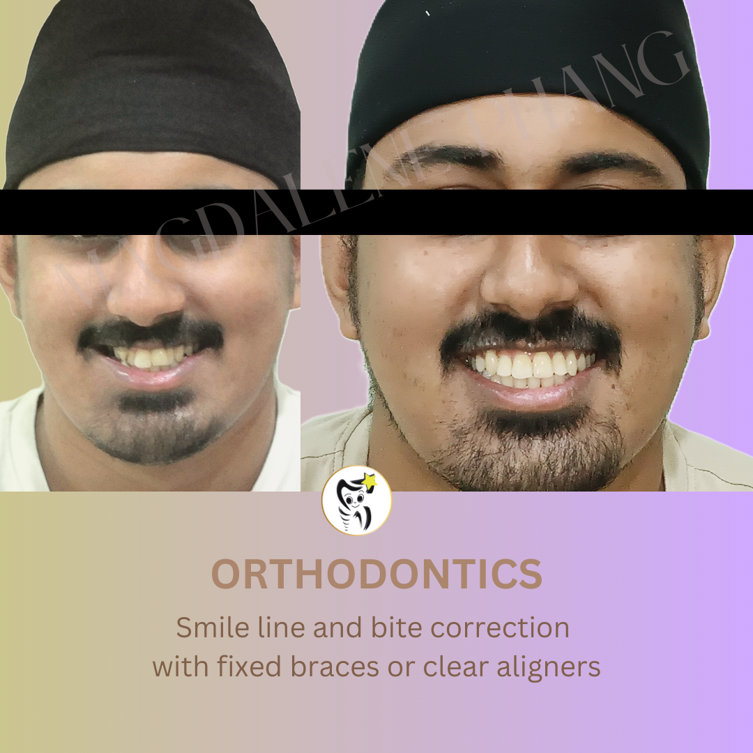Before and After Dental Treatment